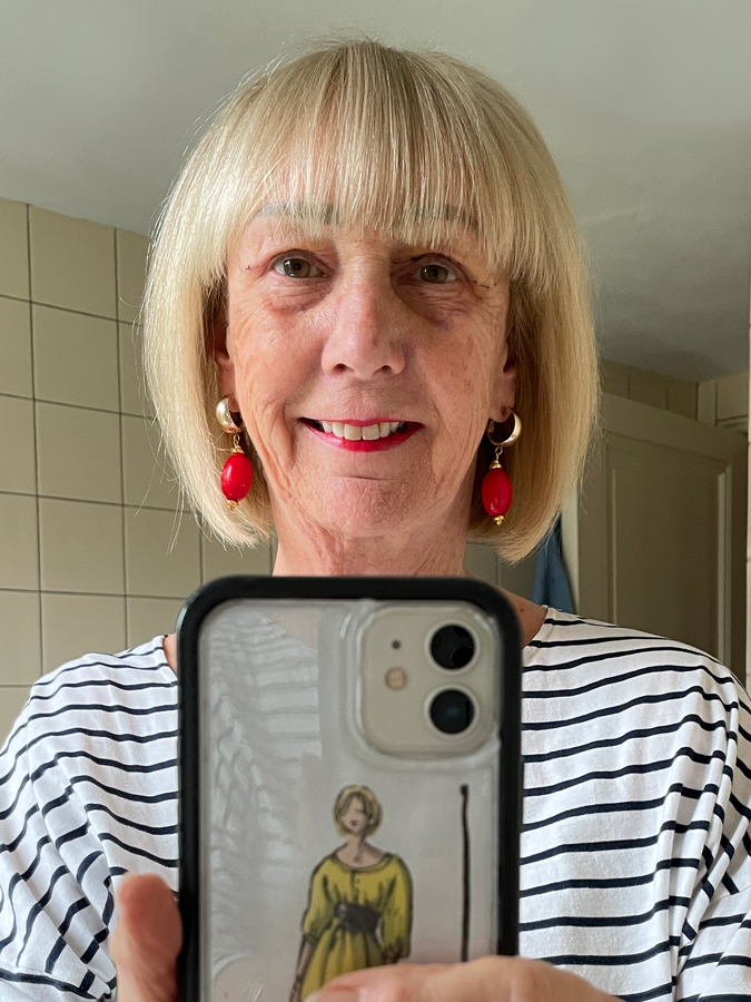 Eyes, a week after the eyelid operation