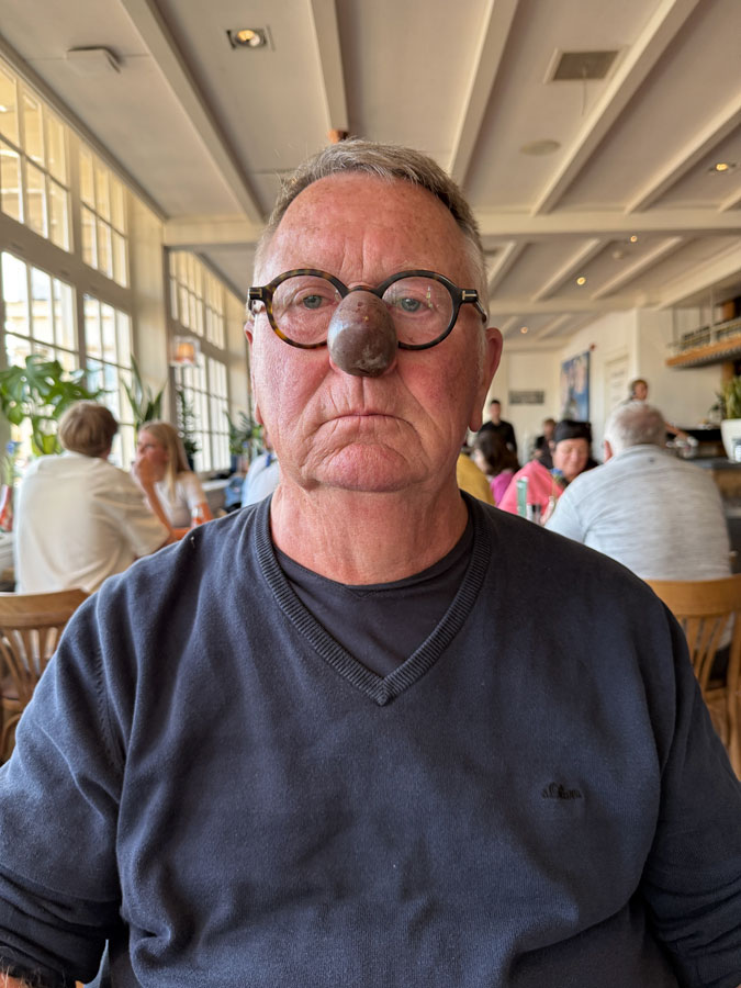 Ron with passion fruit on his nose